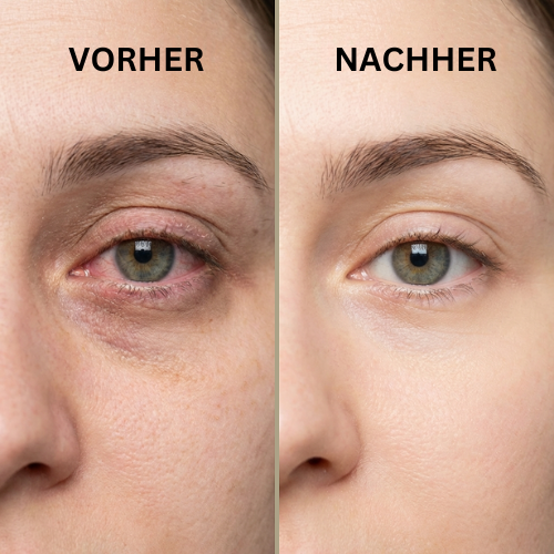 Augen Wohl Dampfstab