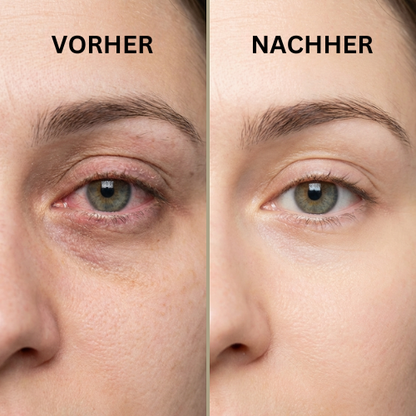 Augen Wohl Dampfstab
